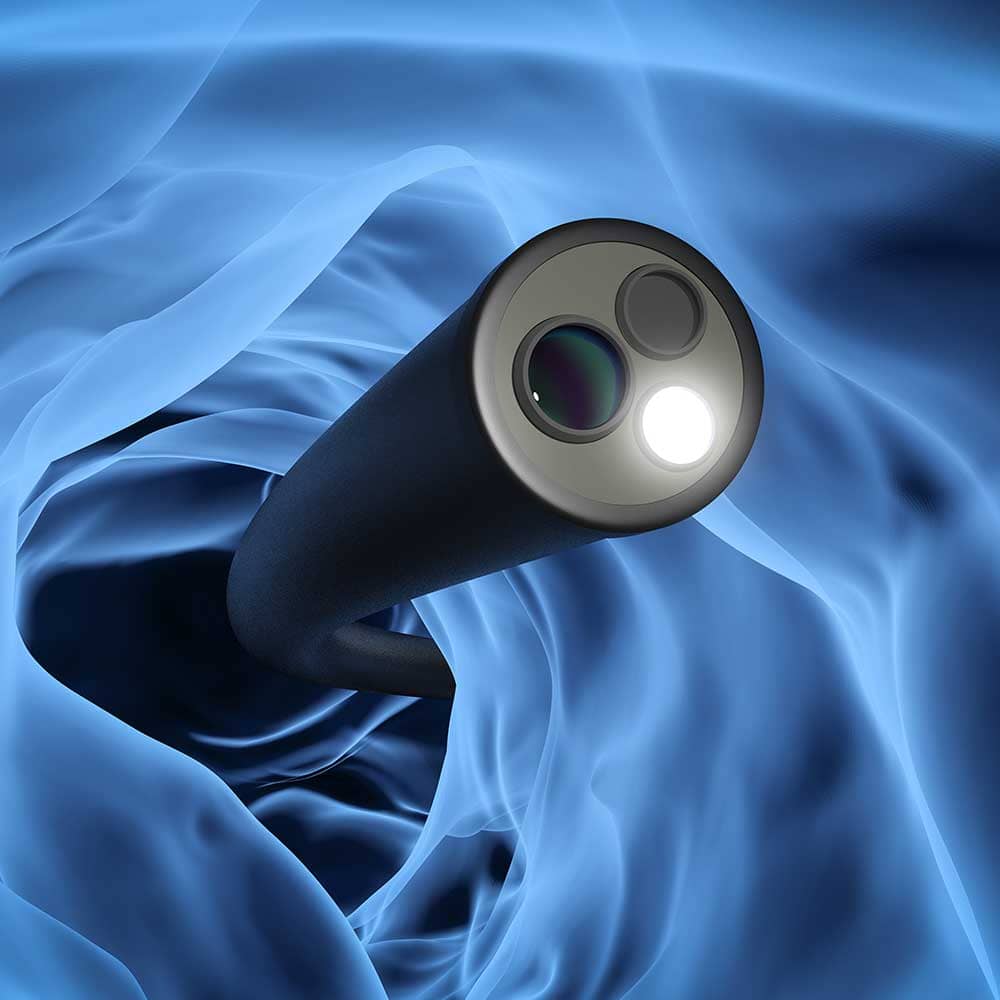 endoscopic microsuction