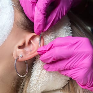 Read more about the article What Is a ‘Conch Removal’, and Can It Lead to Hearing Impairment?