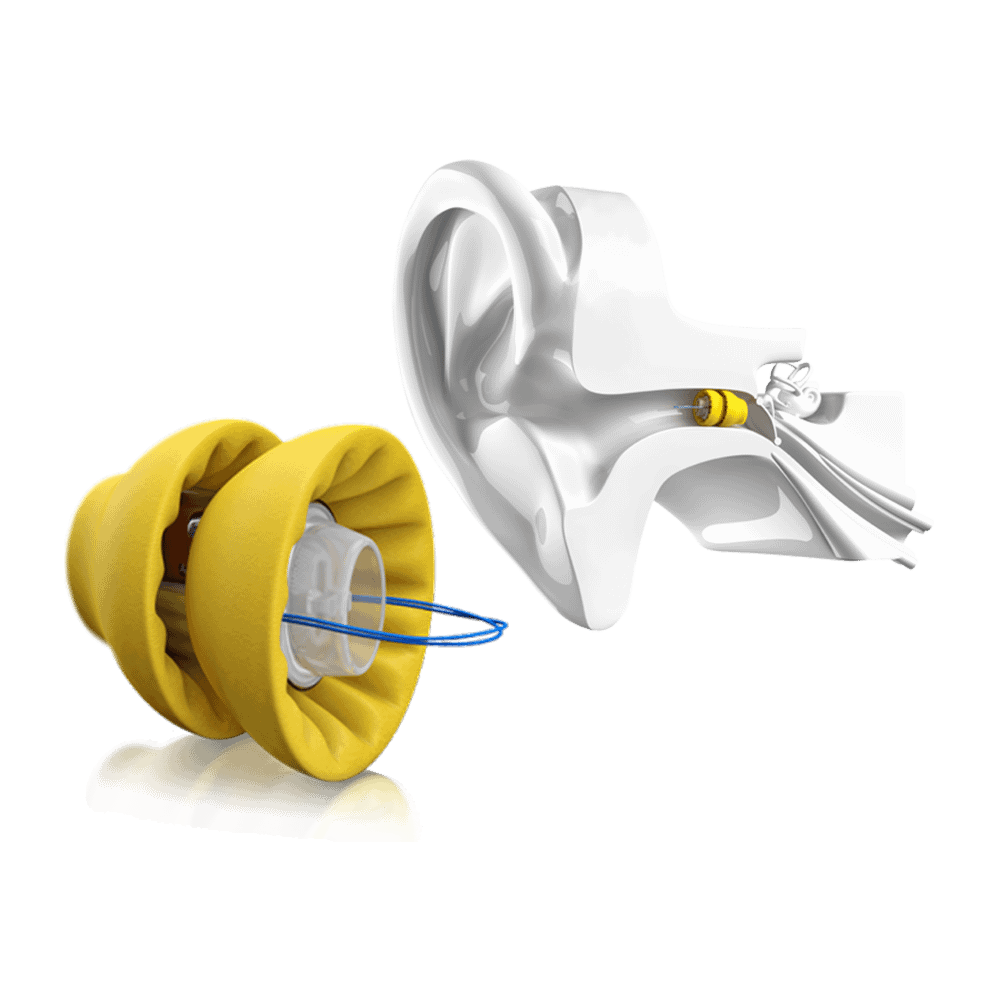 Lyric Hearing Protection plus Diagram