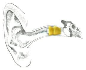 Hearing Protection Diagram