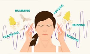 Read more about the article Tinnitus