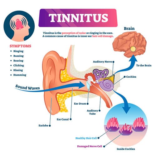 Diagram showing what tinnitus is and how it affects the ear