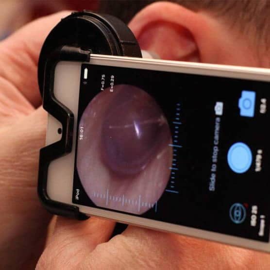 Close Up Of Audiologist Using a IPhone For Endoscopic Microsuction