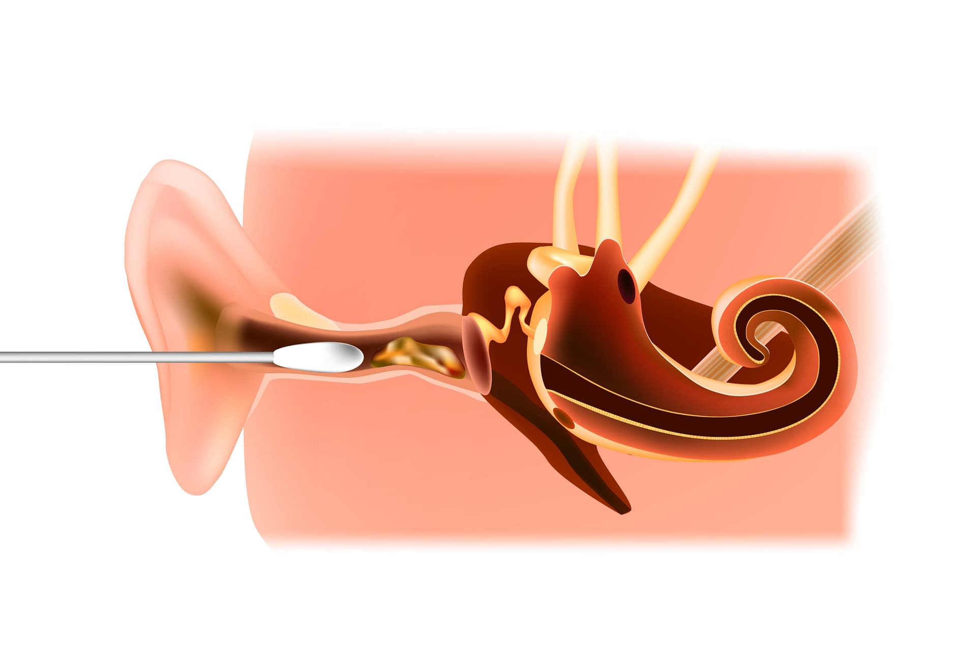 Read more about the article What is Earwax and What Causes It?