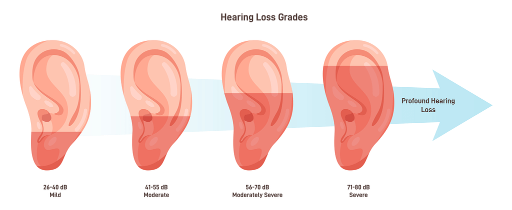 Hearing loss stages. Medical diagnosis of hearing system disease